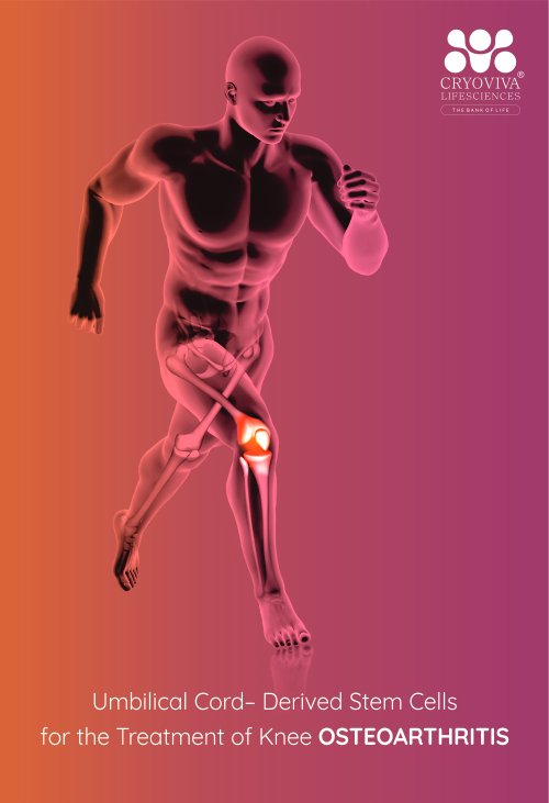 Knee Osteoarthritis 